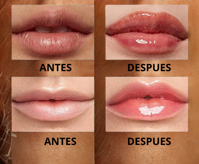 ¡OFERTA 2X1! Labios más llenos y bonitos… sin maquillaje extra