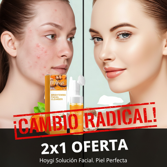 Limpiador facial curcuma✨ Limpia tu piel en profundidad sin resecarla - Con curcuma y activos suaves ✨¡OFERTA 2X1!